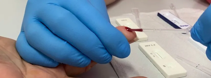 Caraguatatuba amplia ações do Julho Amarelo com orientações e testes rápidos para hepatites virais